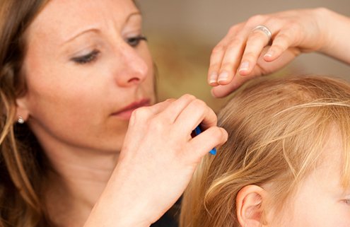 Exactly-How-to-Handle-Head-Lice-at-Your-Child's-School-in-Green-Bay-WI